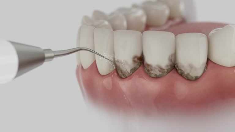 Reliable Invisalign Clear Aligners contractor in Johnson County County, WY by Dentist Open Now